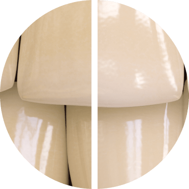 Ennen / jälkeen Opalescence™-hammastahnan käytön